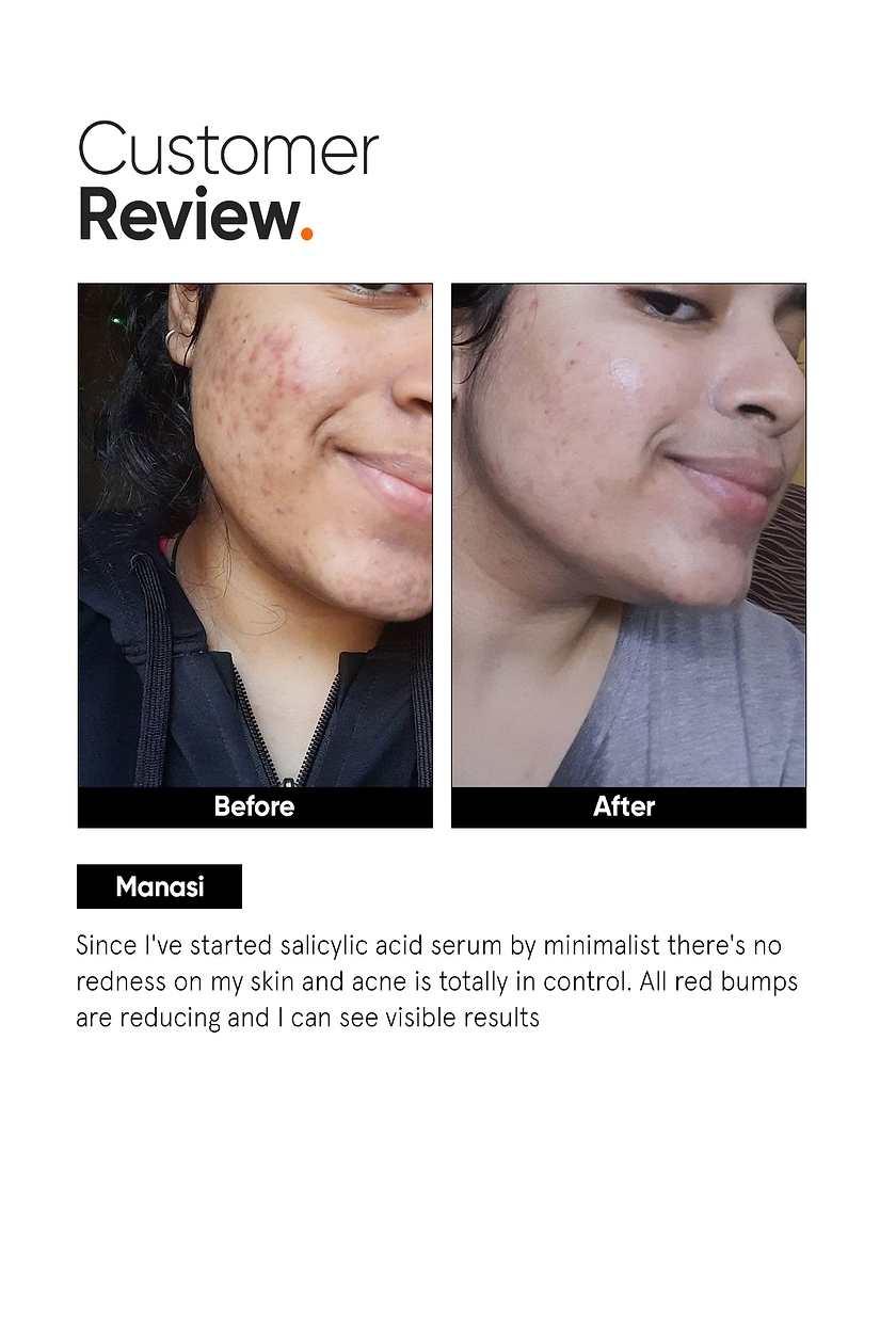 Minimalist Salicylic Acid 2% Face Serum 30ML